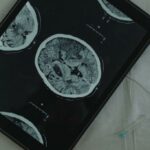 Tablet transmitting a CT scan"